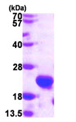 SDS-PAGE - Recombinant Human C1orf41 protein (His tag N-Terminus) (AB107137)