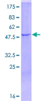 SDS-PAGE - Recombinant Human C1QA protein (AB157982)