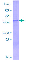 SDS-PAGE - Recombinant Human C1QA protein (GST tag N-Terminus) (AB157982)