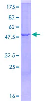 SDS-PAGE - Recombinant Human C1QA protein (GST tag N-Terminus) (AB157982)