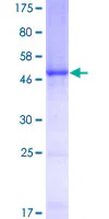 SDS-PAGE - Recombinant Human C1QB protein (AB157983)