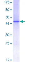 SDS-PAGE - Recombinant Human C1QC protein (AB157984)