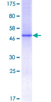 SDS-PAGE - Recombinant Human C1QC protein (GST tag N-Terminus) (AB157984)