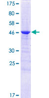 SDS-PAGE - Recombinant Human C1QL1 protein (GST tag N-Terminus) (AB161187)