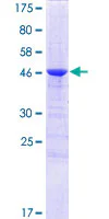 SDS-PAGE - Recombinant Human C1QL1 protein (GST tag N-Terminus) (AB161187)