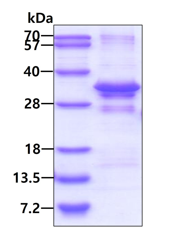 SDS-PAGE - Recombinant Human C20orf20 protein (AB116163), expandable thumbnail