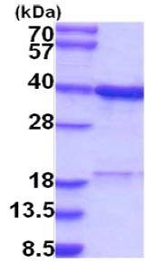 SDS-PAGE - Recombinant Human C20orf77 protein (AB202606), expandable thumbnail