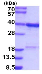 SDS-PAGE - Recombinant Human C20orf77 protein (AB202606)