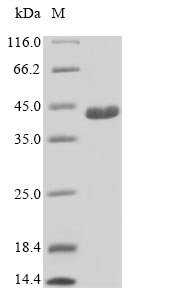 SDS-PAGE - Recombinant Human C21orf2 protein (AB235733), expandable thumbnail