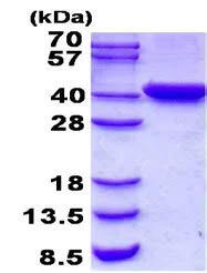 SDS-PAGE - Recombinant Human C2orf60 protein (AB139236)