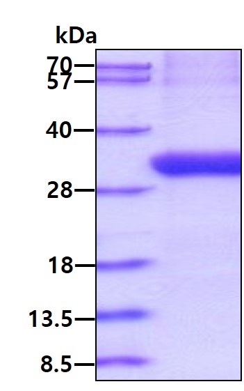 SDS-PAGE - Recombinant Human C4 binding protein/C4BPB (AB130028)