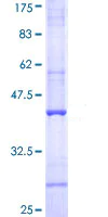 SDS-PAGE - Recombinant Human C4b protein (AB114287)