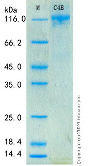 SDS-PAGE - Recombinant Human C4b Protein Standard (His tag) (AB316640)