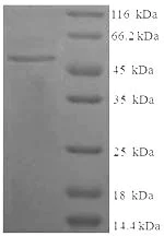 SDS-PAGE - Recombinant Human C4b protein (Tagged) (AB236195)