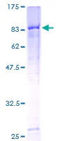 SDS-PAGE - Recombinant Human C4BPA protein (AB157987)