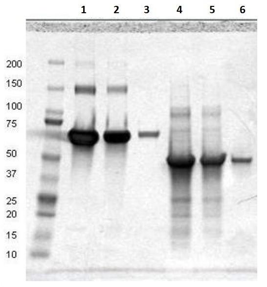 SDS-PAGE - Recombinant Human C4d protein (AB198640), expandable thumbnail