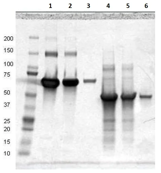 SDS-PAGE - Recombinant Human C4d protein (AB198640)