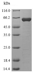 Recombinant Human C4orf27 protein (Tagged)