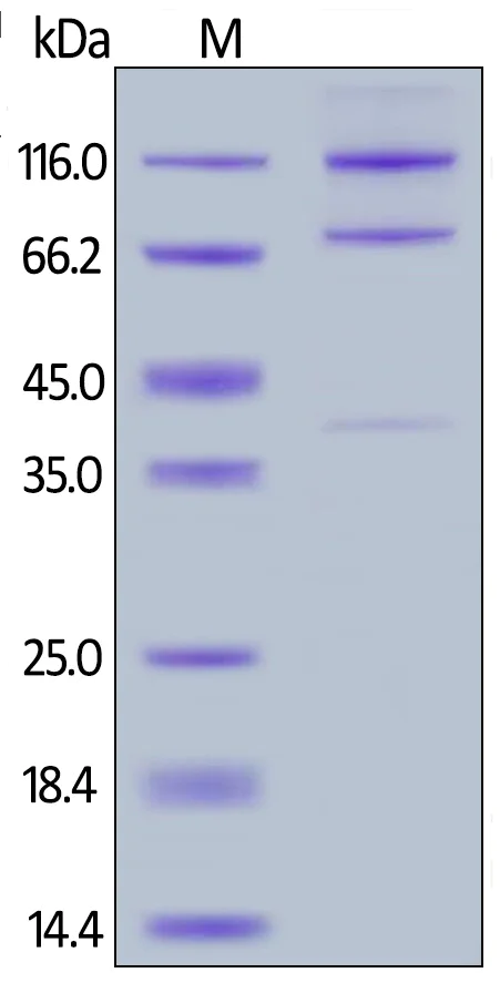 SDS-PAGE - Recombinant human C5 (mutated R885H) protein (Active) (AB256520)