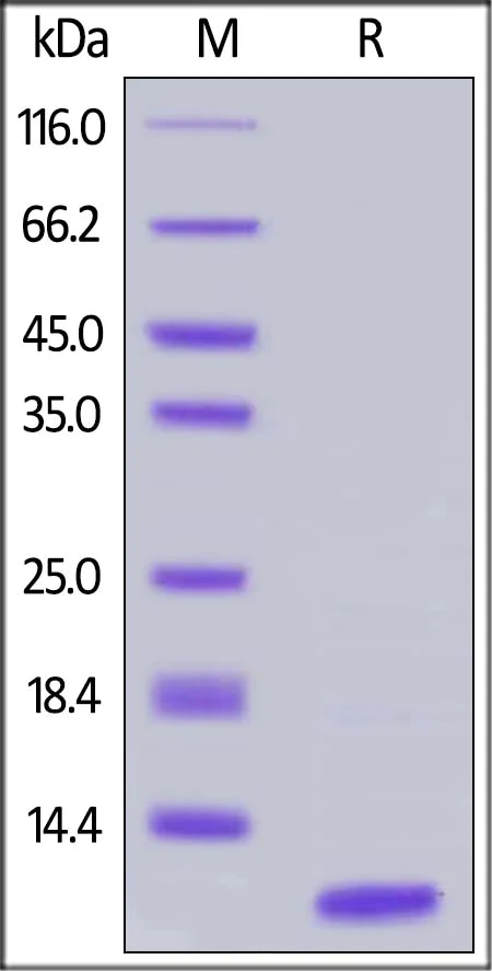 SDS-PAGE - Recombinant human C5a protein (AB167724)