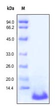 SDS-PAGE - Recombinant human C5a protein (AB167724), expandable thumbnail
