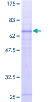 SDS-PAGE - Recombinant Human C5a-R protein (AB157989)