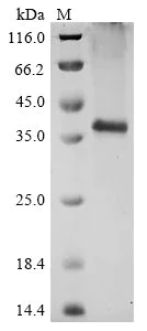 SDS-PAGE - Recombinant Human C5a-R protein (AB289773)