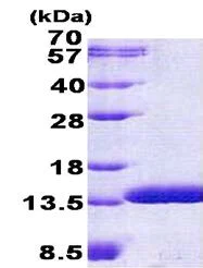 SDS-PAGE - Recombinant Human C6orf115 protein (His tag N-Terminus) (AB156321)