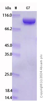 SDS-PAGE - Recombinant Human C7 Protein Standard (His tag) (AB316560)