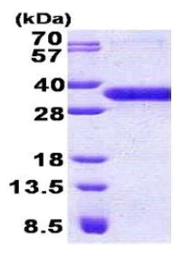 SDS-PAGE - Recombinant Human C7orf36 protein (His tag N-Terminus) (AB167865)