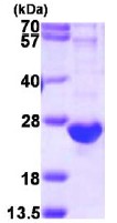 SDS-PAGE - Recombinant Human C8G protein (His tag N-Terminus) (AB113121)