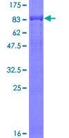 Recombinant Human C9 protein