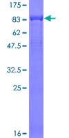 SDS-PAGE - Recombinant Human C9 protein (AB114199)