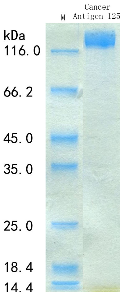 SDS-PAGE - Recombinant Human CA125 Protein Standard (His tag) (AB316438), expandable thumbnail