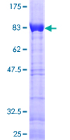 SDS-PAGE - Recombinant Human CAB3 protein (AB132175), expandable thumbnail