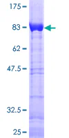 SDS-PAGE - Recombinant Human CAB3 protein (GST tag N-Terminus) (AB132175)