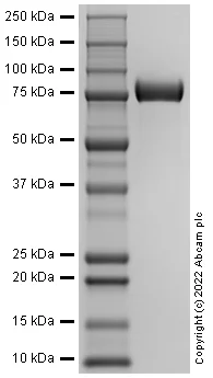 SDS-PAGE - Recombinant Human CADH2 Protein (AB288796)