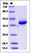 SDS-PAGE - Recombinant Human CALCB protein (Fc Chimera) (AB276526)