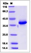SDS-PAGE - Recombinant Human CALCB protein (Fc Chimera) (AB276526)