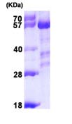 SDS-PAGE - Recombinant Human Calcineurin A protein (AB101870), expandable thumbnail