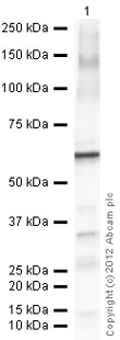 Western blot - Recombinant Human Calcineurin A protein (AB101870), expandable thumbnail