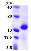 SDS-PAGE - Recombinant Human Calcineurin BII/PPP3R2 protein (AB105609), expandable thumbnail