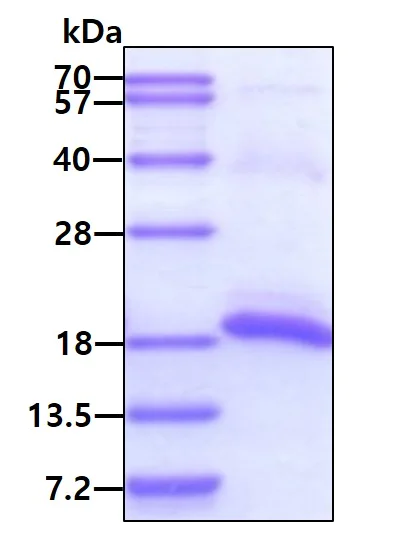SDS-PAGE - Recombinant Human Calcineurin BII/PPP3R2 protein (His tag N-Terminus) (AB105609)