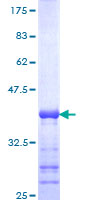 SDS-PAGE - Recombinant Human Calcineurin inhibitor protein (GST tag N-Terminus) (AB153232)