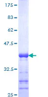 SDS-PAGE - Recombinant Human Calcineurin inhibitor protein (GST tag N-Terminus) (AB153232)