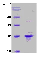 SDS-PAGE - Recombinant Human Calcipressin 1/RCAN1 protein (Tag Free) (AB63837)