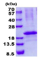SDS-PAGE - Recombinant Human Calcipressin 3 protein (denatured) (His tag N-Terminus) (AB137168)