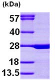 SDS-PAGE - Recombinant Human Calcium binding protein P22 (AB99141), expandable thumbnail