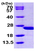 SDS-PAGE - Recombinant Human calcyphosine protein (His tag N-Terminus) (AB105131)