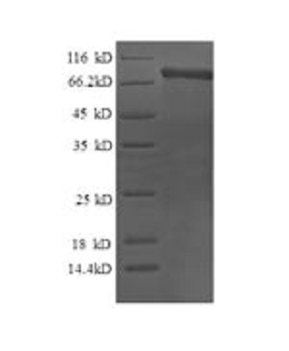 SDS-PAGE - Recombinant Human Calpain 2 protein (His tag) (AB231157), expandable thumbnail